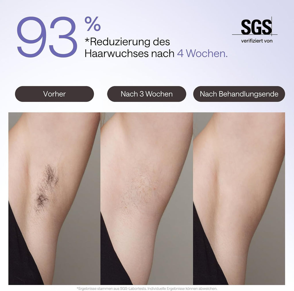 IPL Haarentfernungsgerät Air 3 Deluxe Saphir Kühlung UV Sterilisator Aloe Gel Gesicht Körper für Zuhause