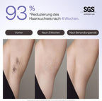 IPL Haarentfernungsgerät Air 3 Deluxe Saphir Kühlung UV Sterilisator Aloe Gel Gesicht Körper für Zuhause