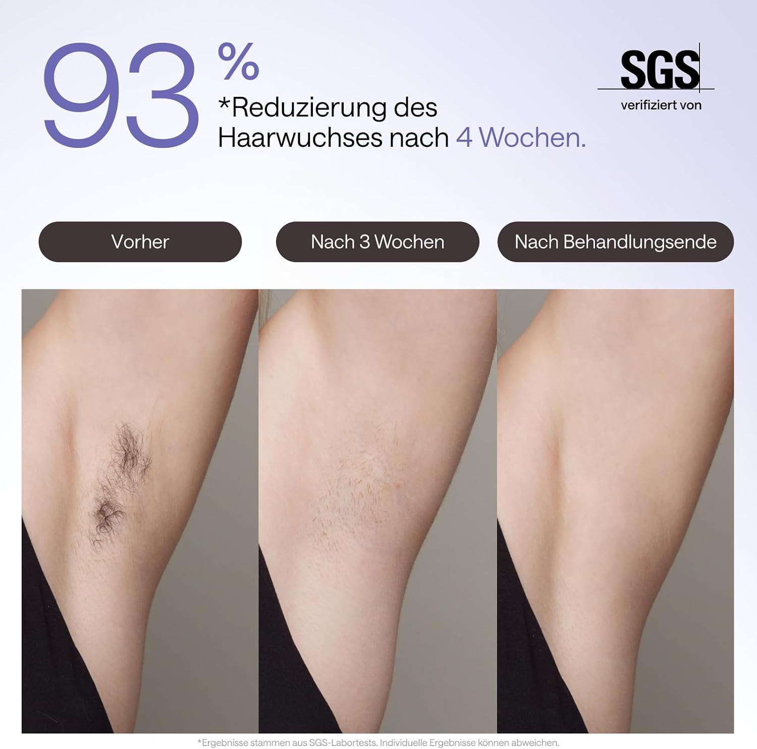 IPL Haarentfernungsgerät Air 3 Deluxe Saphir Kühlung UV Sterilisator Aloe Gel Gesicht Körper für Zuhause